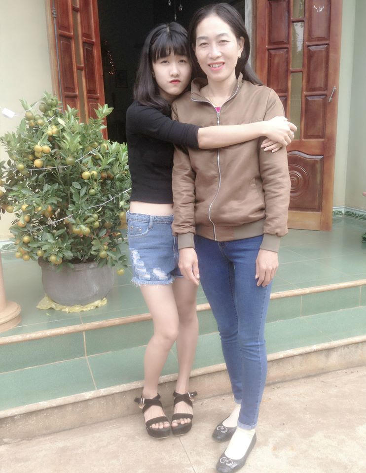 Chia sẻ lúc nửa đêm của nữ sinh bị cưa chân