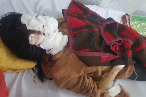 Chia sẻ với nỗi đau nạn nhân, “chong đèn” xử lý hậu quả vụ nổ