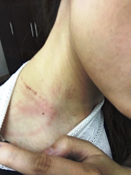 Xem xét cấm bay khách nam đánh nữ nhân viên hàng không