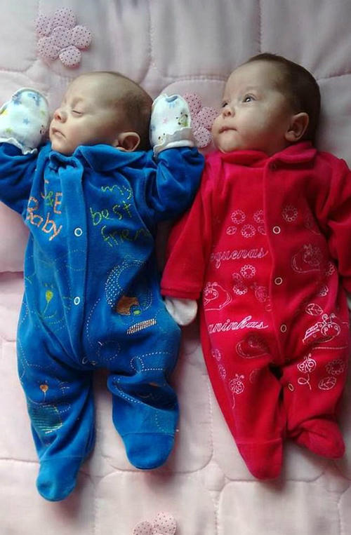 Cặp song sinh chào đời từ người mẹ chết não hơn 4 tháng