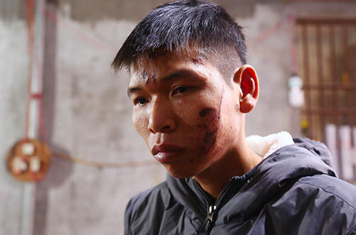 Anh Đặng Đình Tiến thẫn thờ khi mất nhà, mất con. Ảnh: Phạm Dự.