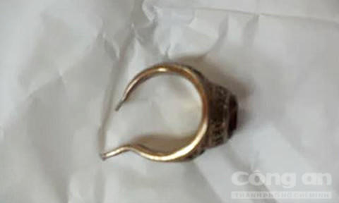 Ông già 68 tuổi phải cấp cứu vì đeo nhẫn vào 'của quý'