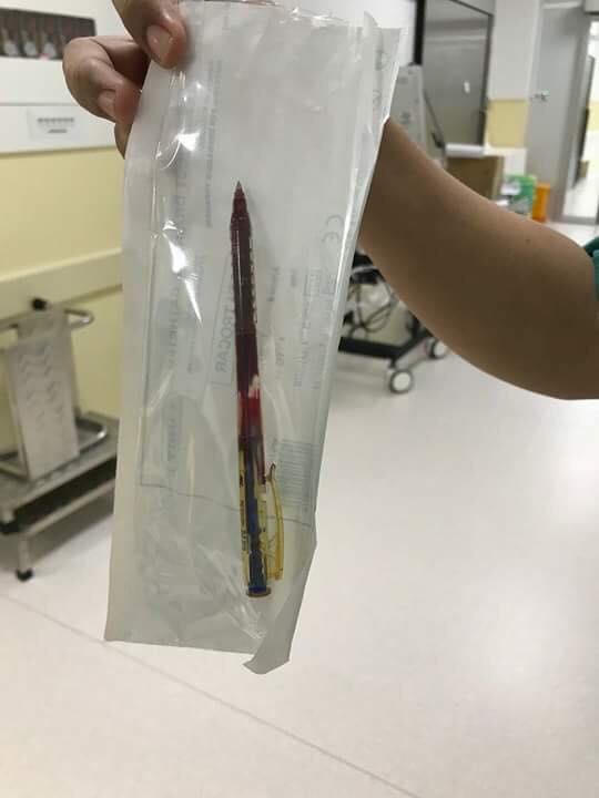 Bé gái 4 tuổi bị bút bi đâm thấu ngực