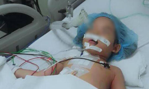 Bé gái 4 tuổi bị bút bi đâm thấu ngực