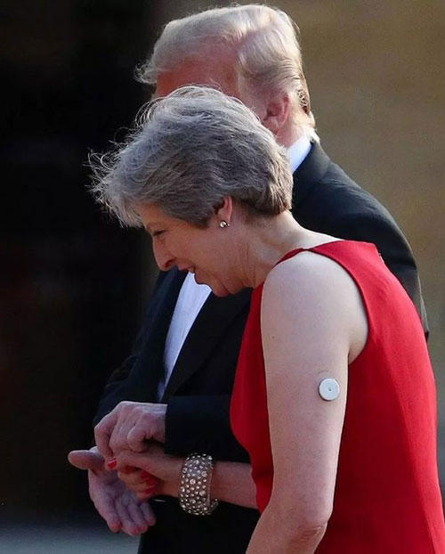 Thiết bị đo lượng đường huýet dán trên tray trái của bà Theresa May. Ảnh: Reuters.