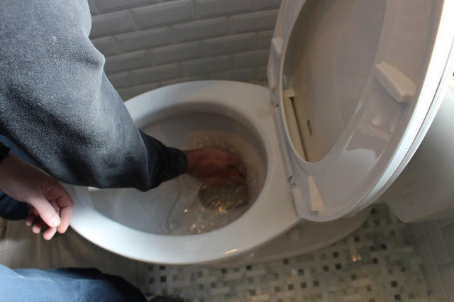 Bỏng nặng vì dùng a xít đậm đặc thông bồn cầu