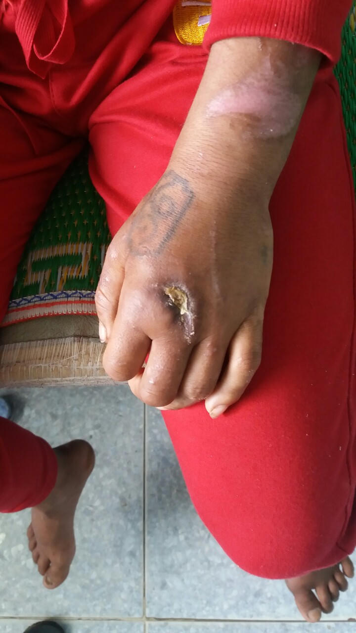 Cô gái làm thuê nghi bị bà chủ bạo hành như thời trung cổ