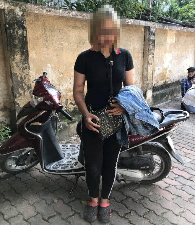 Hà Nội: Thiếu nữ 15 tuổi đi xe máy đâm cảnh sát cơ động gãy chân