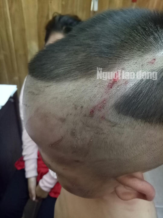 Giải cứu bé trai 3 tuổi bị cha dượng đánh dã man ở Phú Quốc - Ảnh 3.