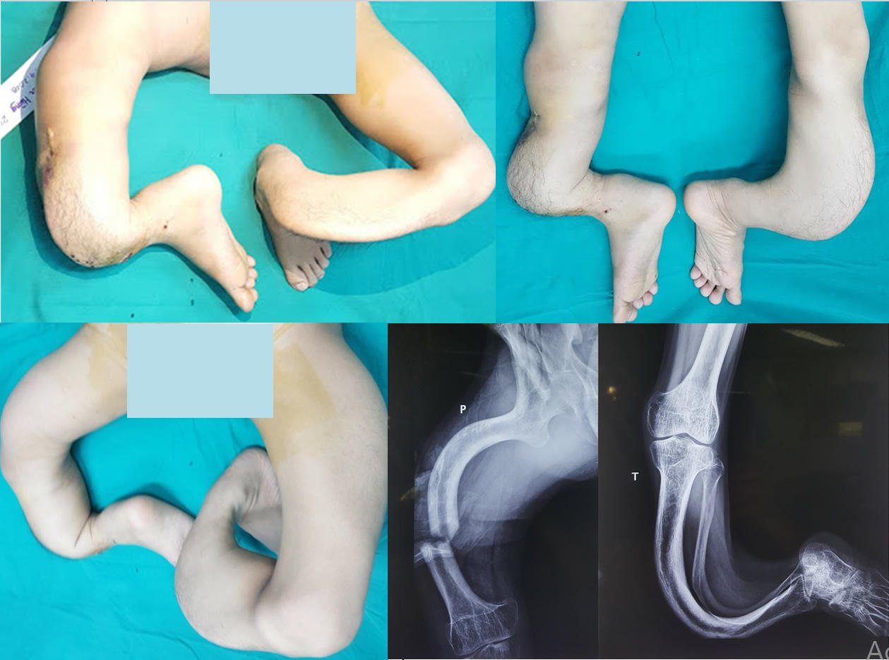 Kỳ tích 'hoàng tử ếch' Nam Định biến thành người bình thường