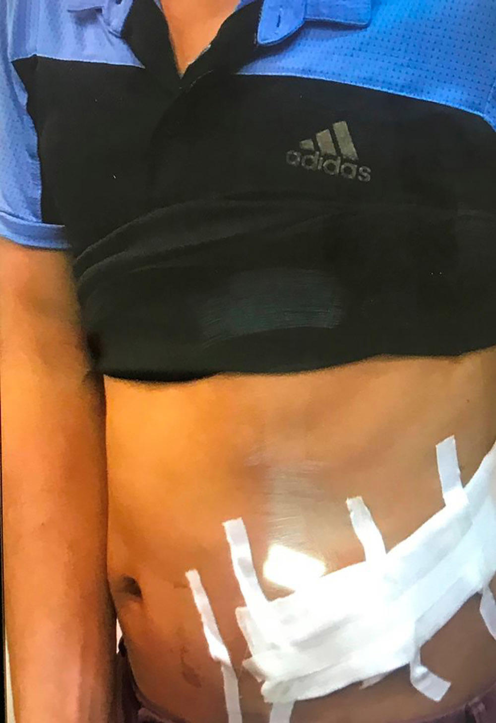 Đường dây buôn bán nội tạng xuyên quốc gia lớn nhất Việt Nam