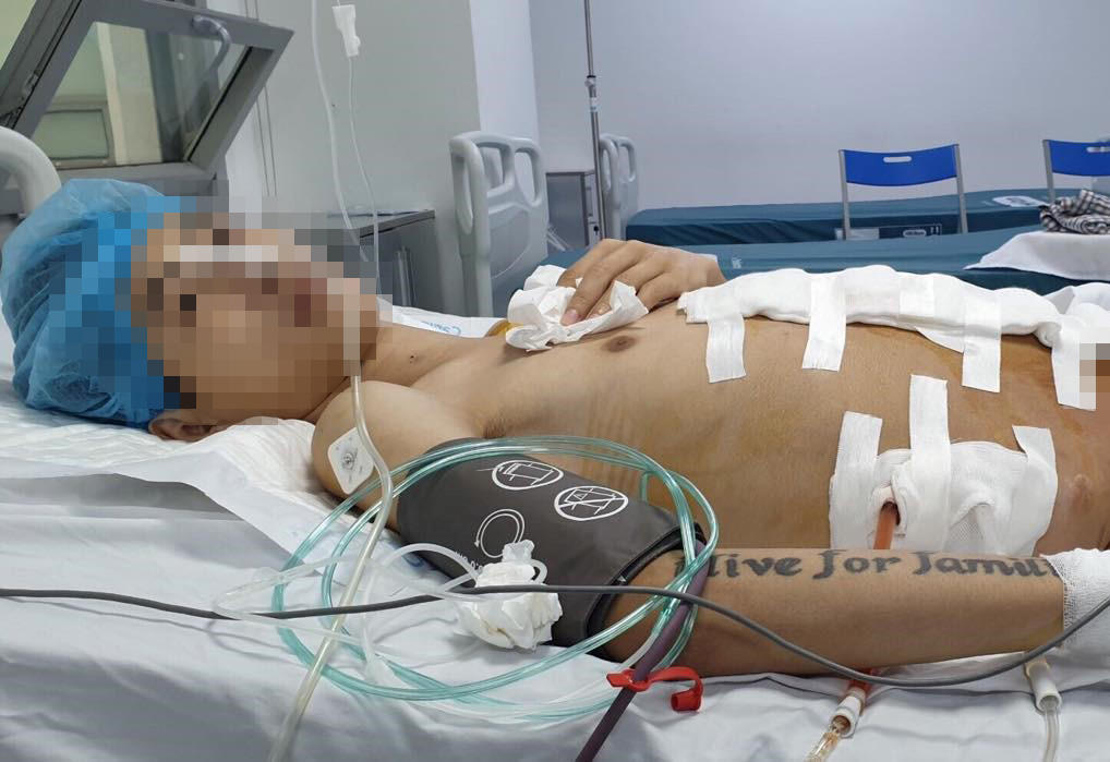 'Choáng' trước khối u 25kg lôi ra từ bụng nam thanh niên