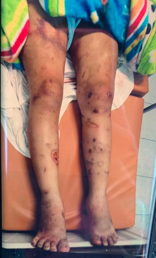 Thông tin sốc vụ thai phụ 18 tuổi bị giam, tra tấn khiến thai nhi tử vong - 2