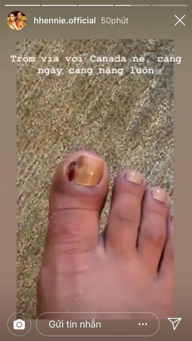 Sự thật khiến Hoa hậu HHen Niê đi... dép tổ ong - 6 Sự thật khiến Hoa hậu HHen Niê đi... dép tổ ong - 6