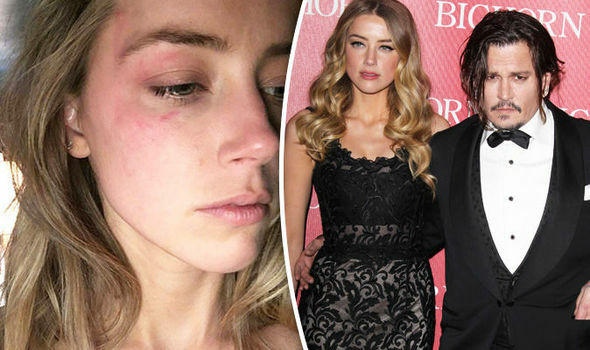 Amber đã đăng nhiều bức ảnh mặt thâm tím như là bằng chứng cho thấy chồng cũ rất vũ phu.