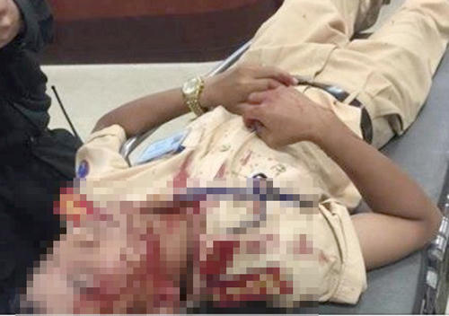 Đại uý Sơn bị tấn công khiến bị thương vùng đầu.