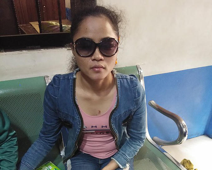 Glory Cuerda (27 tuổi) hiện bị mù cả hai mắt sau khi bị tạt axit tại thành phố Pasay, Philippines hồi cuối tháng 7. Ảnh: Viral Press.