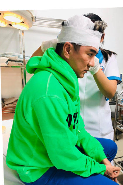 Đàm Vĩnh Hưng bị tai nạn trên sân khấu - 1