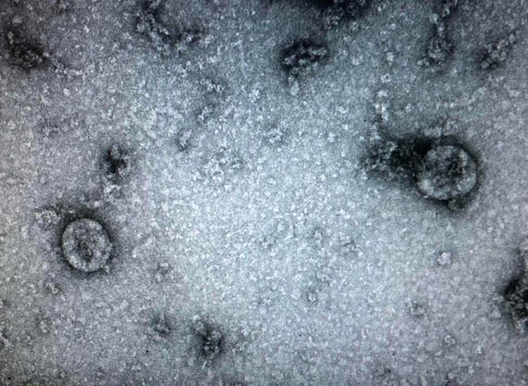 nCoV được các nhà khoa học Việt phân lập thành công. Ảnh: Viện Vệ sinh Dịch tễ Trung ương.