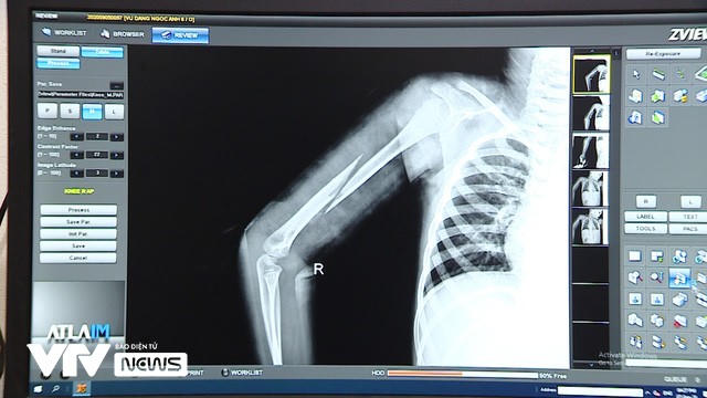 Bé gái bị bố đẻ bạo hành ở Bắc Ninh: Bố bảo đánh cho chừa mà con có mắc tội gì đâu - Ảnh 1. Bé gái bị bố đẻ bạo hành ở Bắc Ninh: Bố bảo đánh cho chừa mà con có mắc tội gì đâu - Ảnh 1.