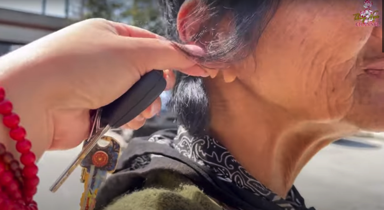 Ca sĩ Kim Ngân sống lang thang tại Mỹ bị kẻ xấu cắt một bên tai - Ảnh 4.