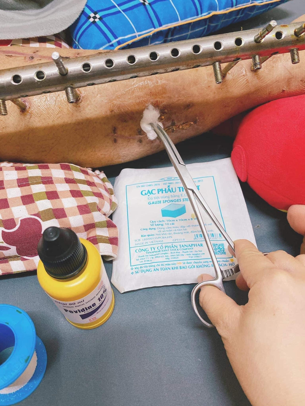 Chồng gặp tai nạn nguy kịch, vợ trẻ bao dung cứu vãn hôn nhân