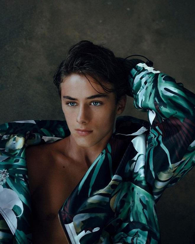 'Cậu bé đẹp trai nhất thế giới' giờ thế nào?