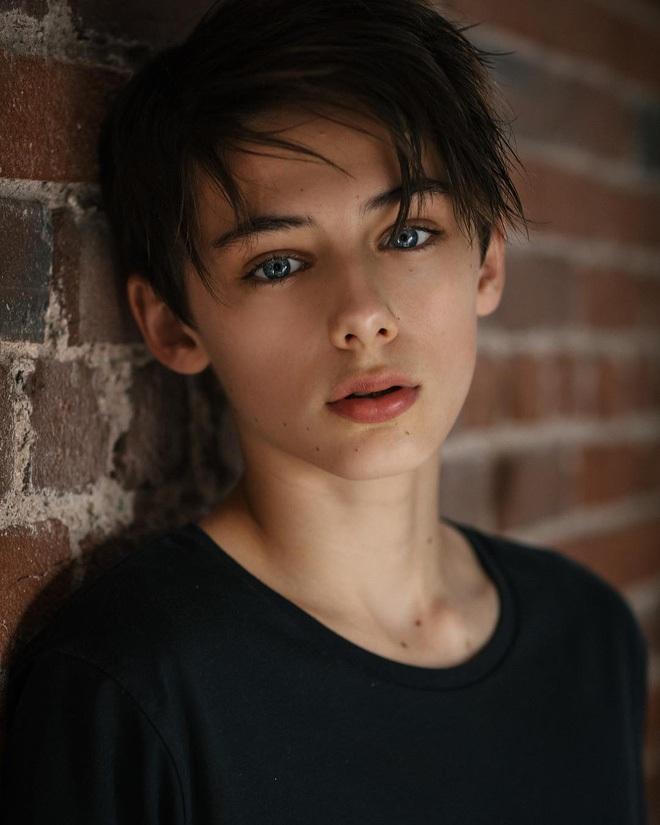 'Cậu bé đẹp trai nhất thế giới' giờ thế nào?