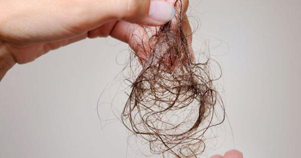 Sau tiêm vaccine COVID-19 bị rụng tóc khiến nhiều người lo lắng, bác sĩ khuyên gì?