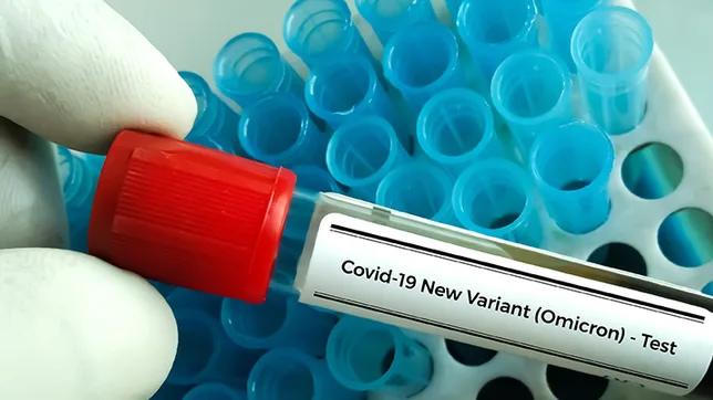 Chuyên gia Nga: Omicron có thể là dấu hiệu đại dịch sắp kết thúc