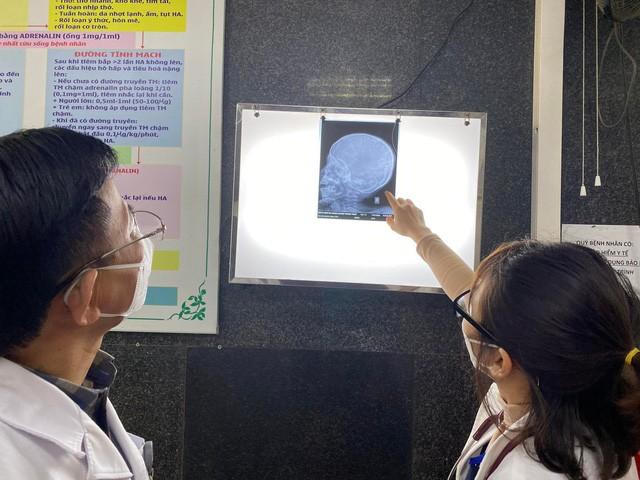 Bé gái bị đóng đinh vào đầu vẫn trong tình trạng rất nặng, chưa thể phẫu thuật - Ảnh 2.