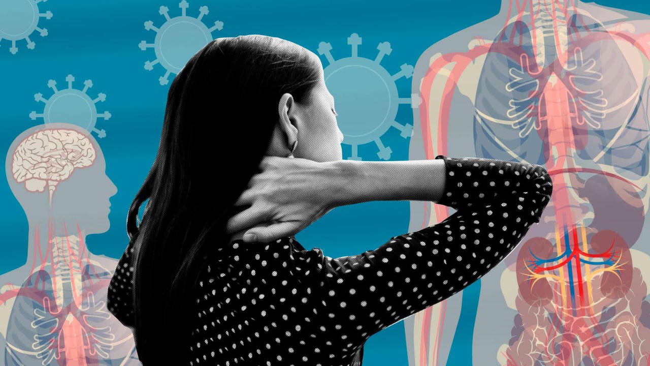 Lý do phụ nữ chịu ảnh hưởng hậu COVID-19 nghiêm trọng hơn nam giới