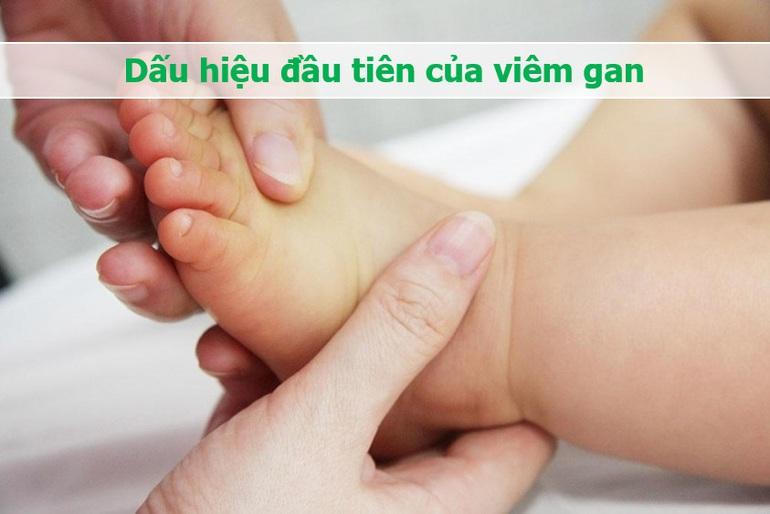 Thông tin bất ngờ về nguồn gốc của dịch viêm gan 'bí ẩn'