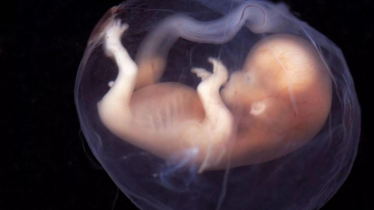 Kỳ lạ bé sơ sinh 40 ngày tuổi mang phôi thai trong bụng