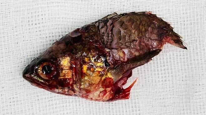 Đi săn cá, người đàn ông suýt chết vì bị cá 'trả thù'