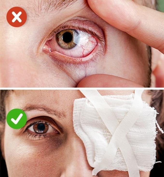 10 sai lầm phổ biến khi xử lý chấn thương, bệnh thường gặp