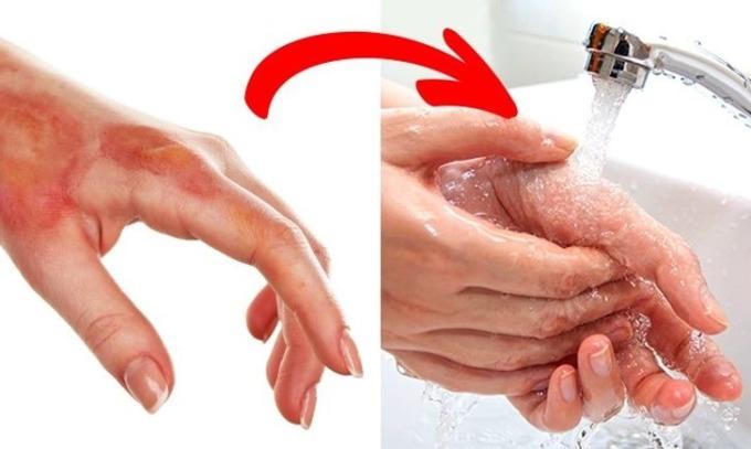 10 sai lầm phổ biến khi xử lý chấn thương, bệnh thường gặp