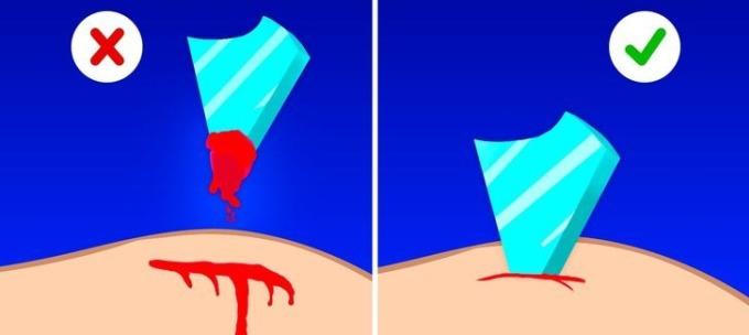 10 sai lầm phổ biến khi xử lý chấn thương, bệnh thường gặp