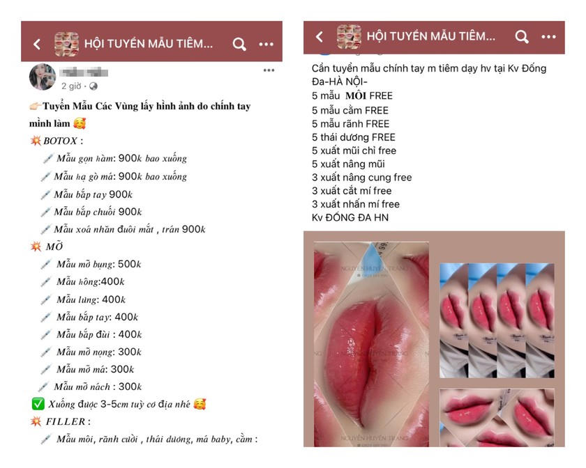 Filler, botox không hoá đơn, tem mác bán 'tràn lan' trên Shopee, Lazada và các mạng xã hội