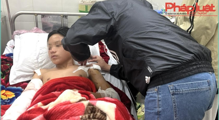 Phạt hành chính chủ chó trong vụ nam sinh bị chó cắn tại Lào Cai 