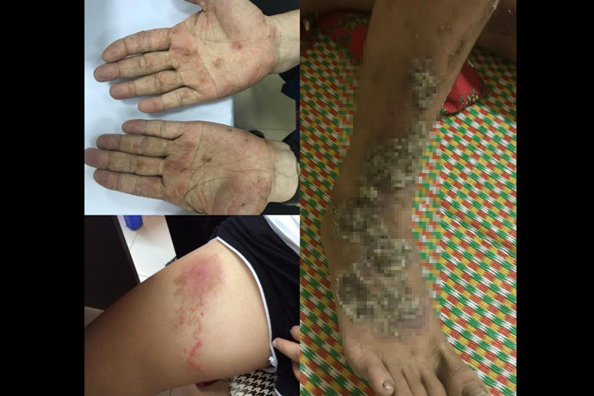 Nam thanh niên 'ôm bệnh' suốt 10 năm vì... thú cưng