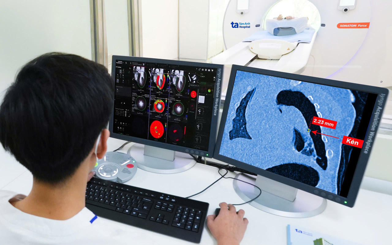 BVĐK Tâm Anh là đơn vị đầu tiên sở hữu siêu máy CT thế hệ mới nhất tại Việt Nam