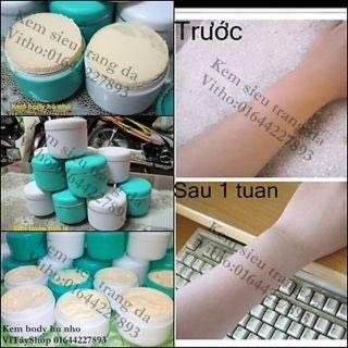 Phát hoảng sau khi sử dụng kem trộn trắng da siêu tốc bán online