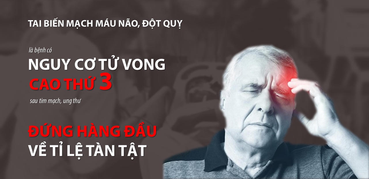 Ứng dụng trí tuệ nhân tạo cảnh báo sớm nguy cơ đột quỵ