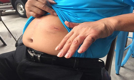 Đâm quản lý quán bar vì xin cơ cấu giải thưởng bất thành