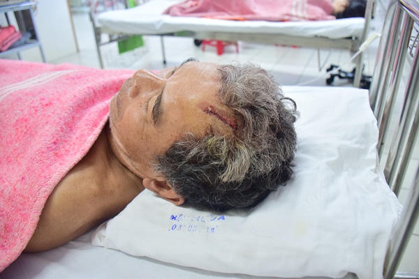 Chủ tịch UBND tỉnh TT- Huế thăm hỏi nạn nhân bị 'cát tặc' tấn công trọng thương