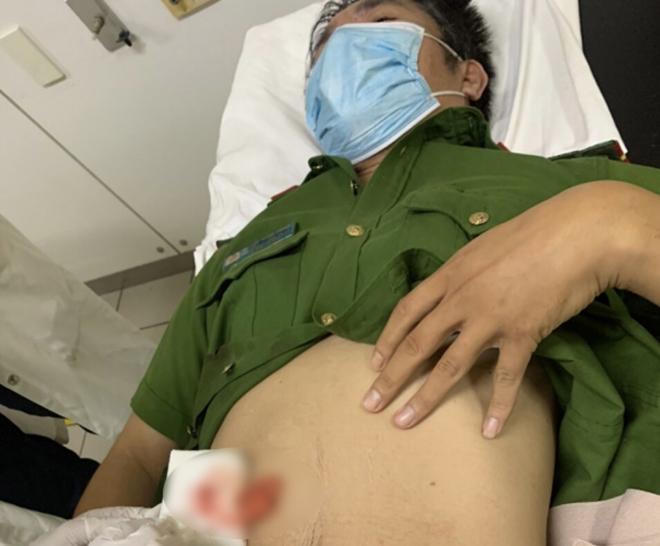Bắt khẩn cấp đối tượng đâm trọng thương Phó trưởng Công an xã Lộc Trì