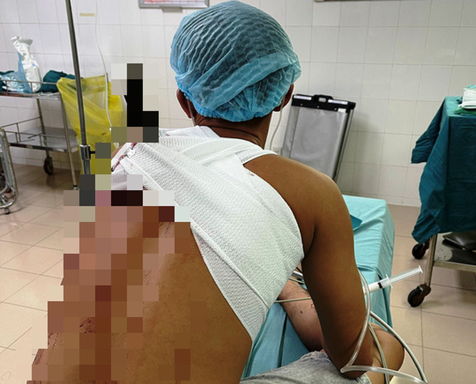 Hỗn chiến vì “xin dừng uống bia”