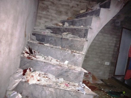 Thuốc pháo phát nổ, nam thanh niên nguy kịch