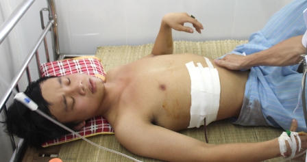 Truy tìm đối tượng đâm trọng thương nhân viên bán vé xe bus